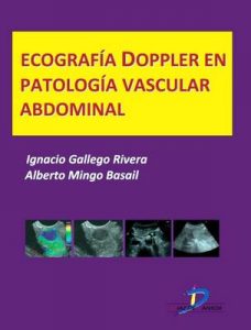 Ecografía Doppler en Patología vascular abdominal (Este capítulo pertenece al libro Tratado de ultrasonografía abdominal) – Ignacio Gallego Rivera, Mingo Basail [ePub & Kindle]